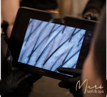 Scalp analysis with a magnifying scalp camera at Maré